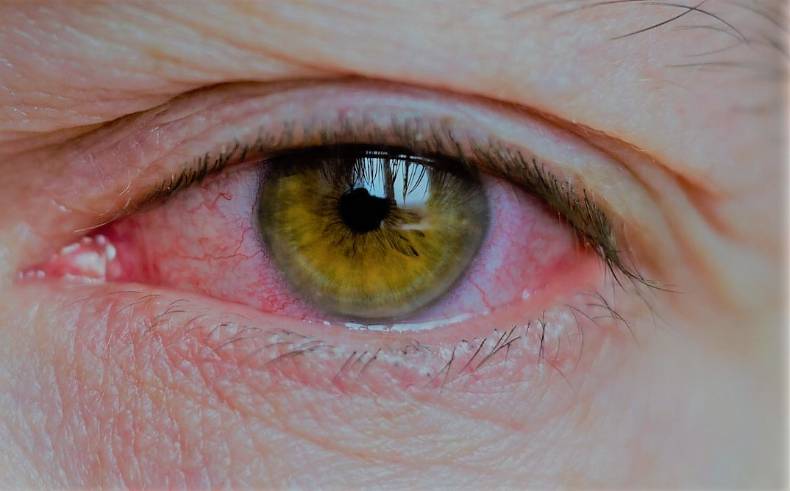 2023 01 30 La uveitis se manifiesta a través de la inflamación de las capas internas del ojo
